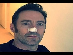 Hugh Jackman